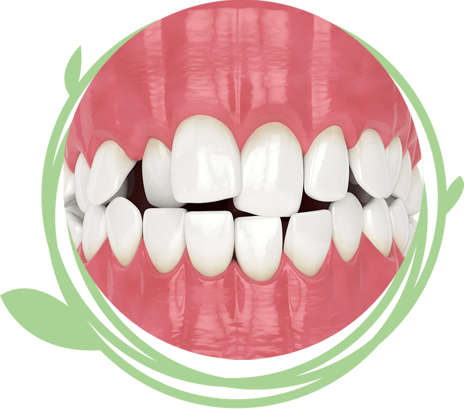 Clovis Family Dentistry|Orthodontics