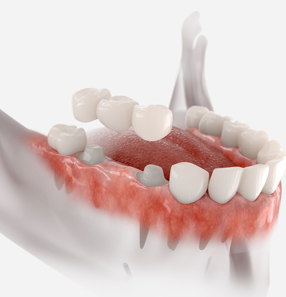 Clovis Family Dentistry|Your Smile Makeover