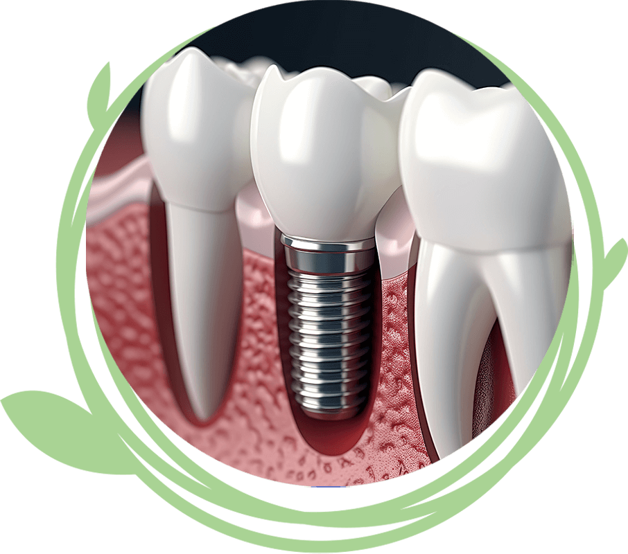 Clovis Family Dentistry|Dental Implant Procedure