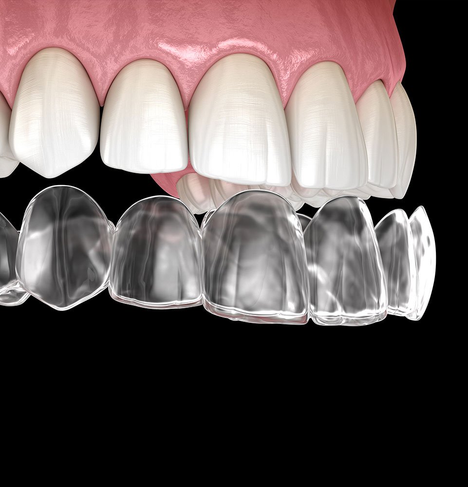 Clovis Family Dentistry|Your Smile Makeover