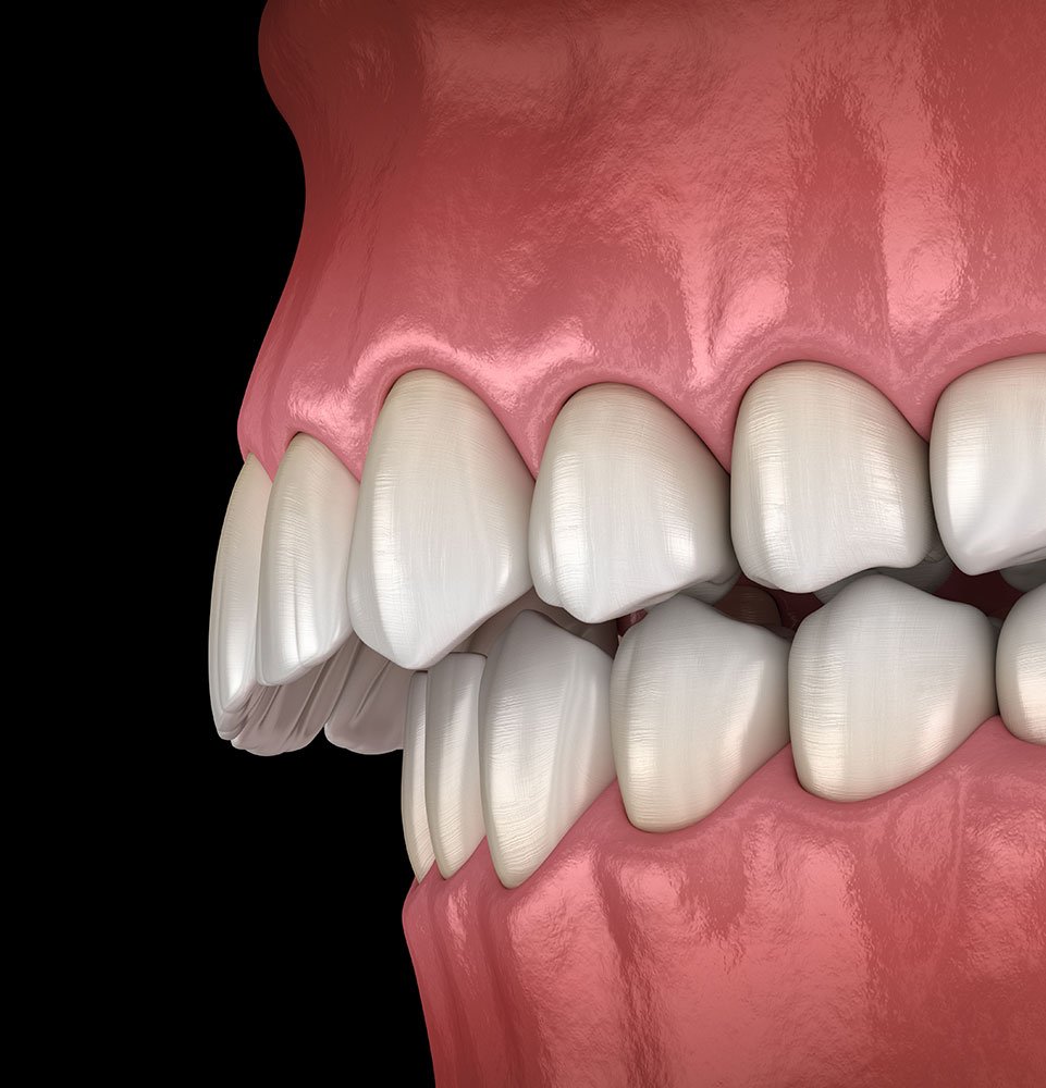 Clovis Family Dentistry|Your Smile Makeover