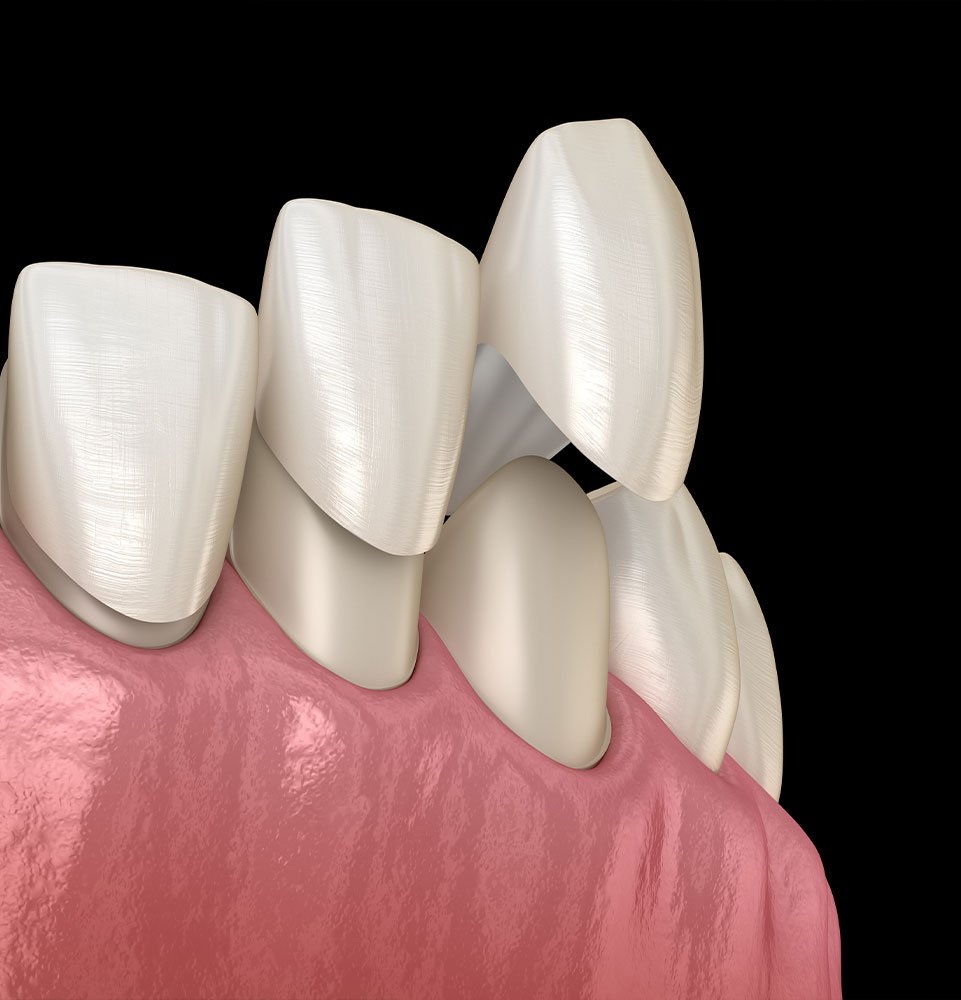 Clovis Family Dentistry|Your Smile Makeover