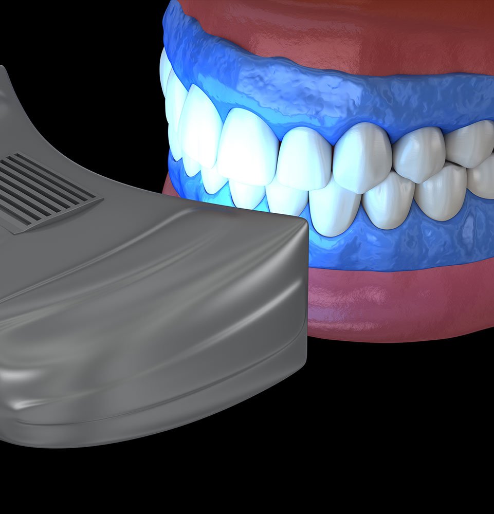 Clovis Family Dentistry|Your Smile Makeover