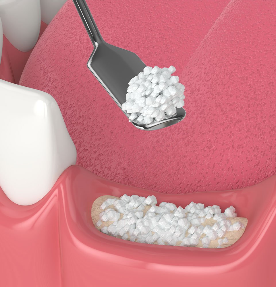 Clovis Family Dentistry|Oral Surgery