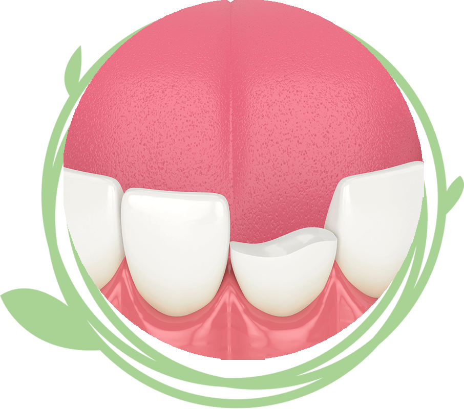 Clovis Family Dentistry|Emergency Dentistry