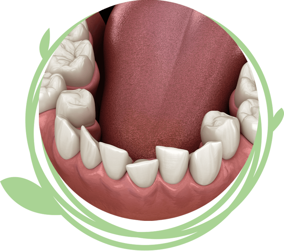 Clovis Family Dentistry|Invisalign® Clear Aligners
