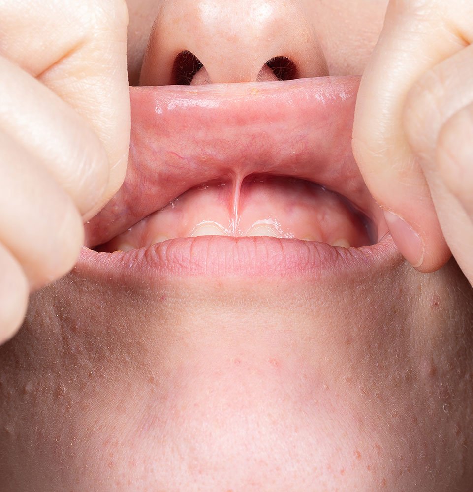 Clovis Family Dentistry|Periodontics