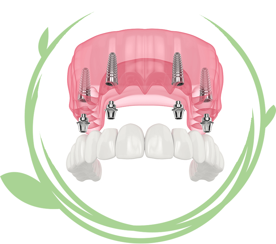 Clovis Family Dentistry|Fixed Teeth vs. Removable