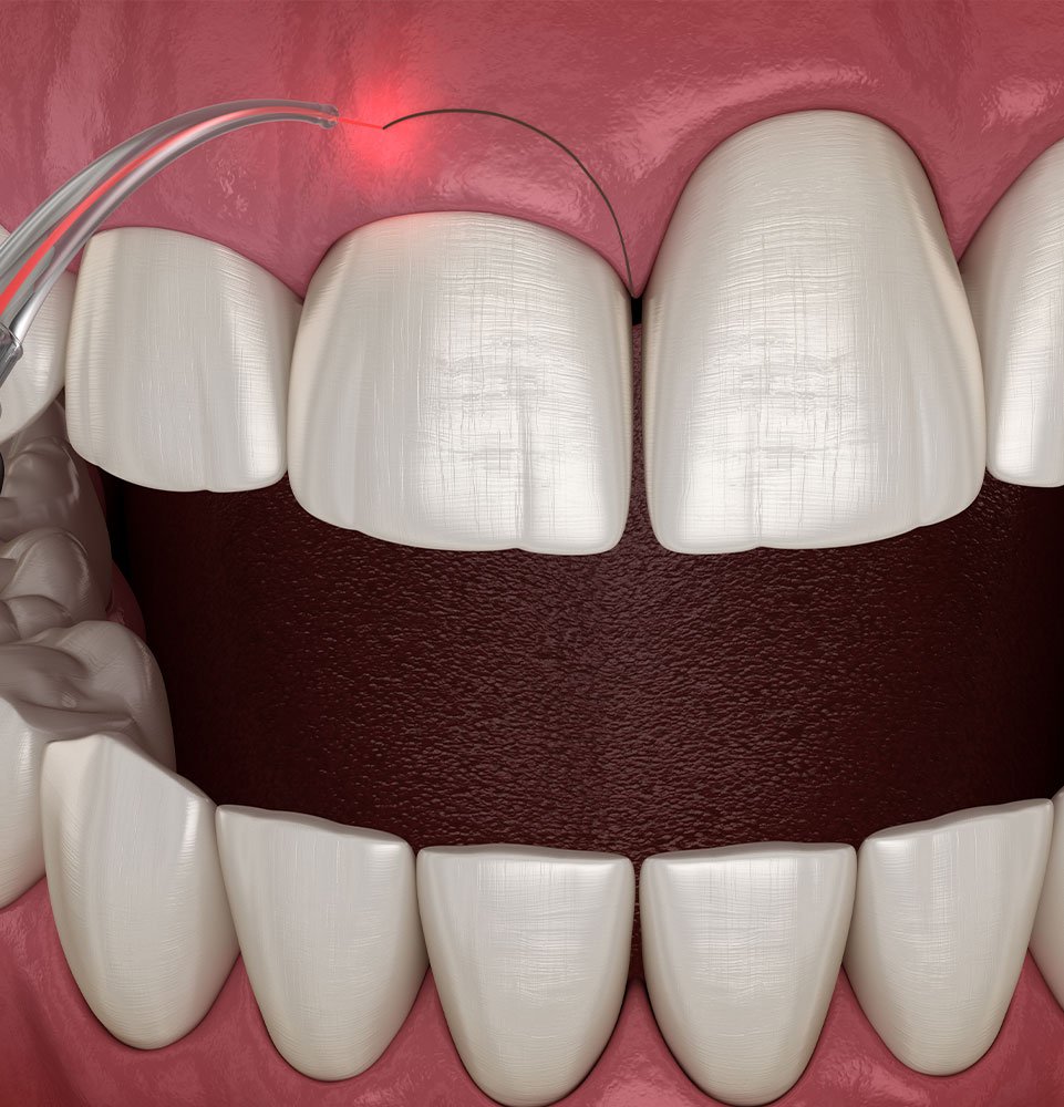 Clovis Family Dentistry|Periodontics