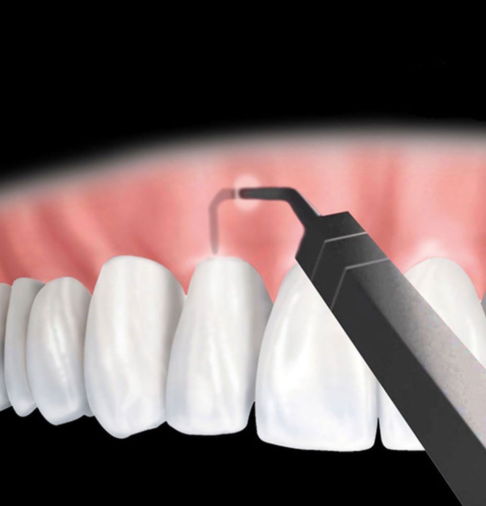 Clovis Family Dentistry|Periodontics