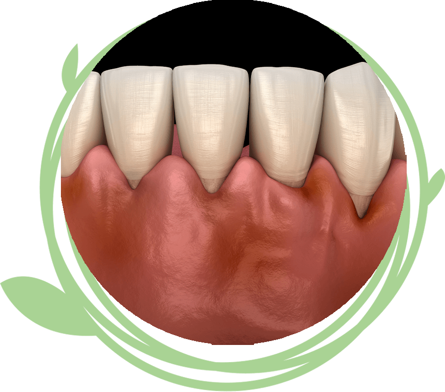 Clovis Family Dentistry|Periodontics