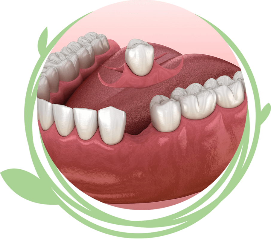 Clovis Family Dentistry|Full & Partial Dentures