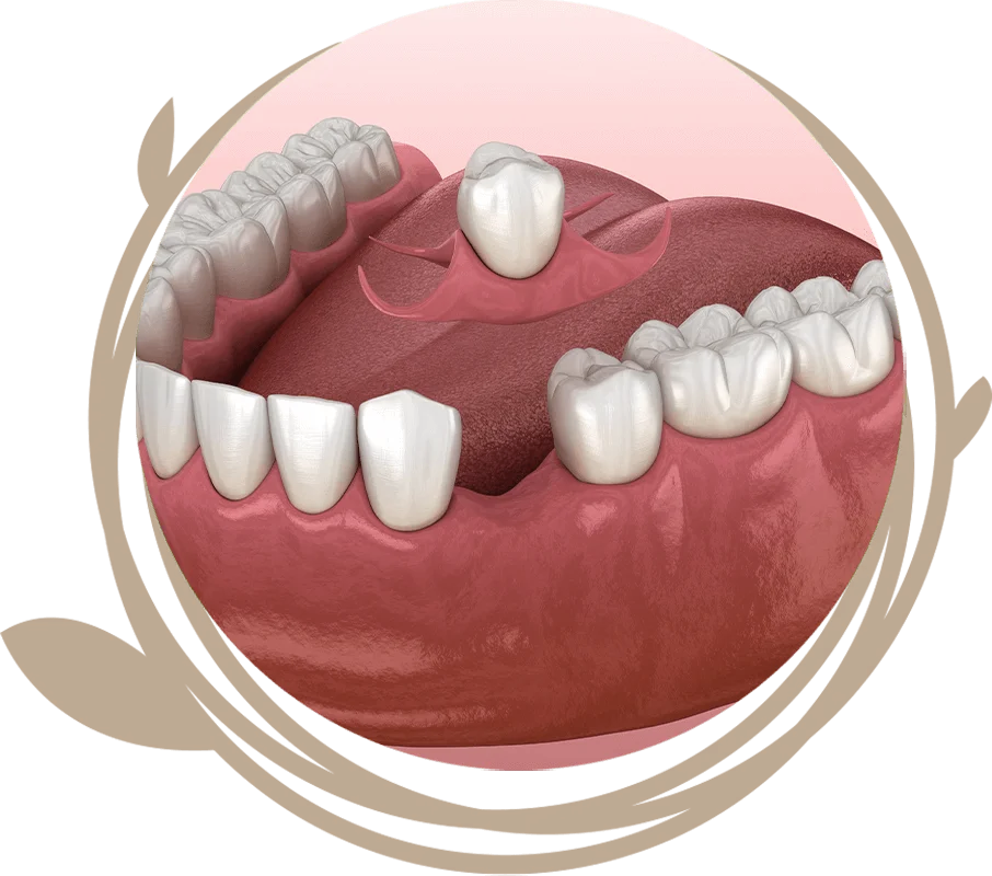 Clovis Family Dentistry|Full & Partial Dentures