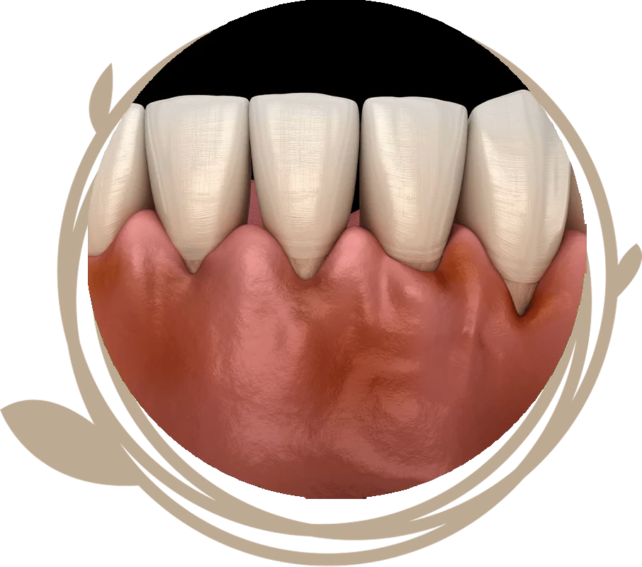 Clovis Family Dentistry|Periodontics
