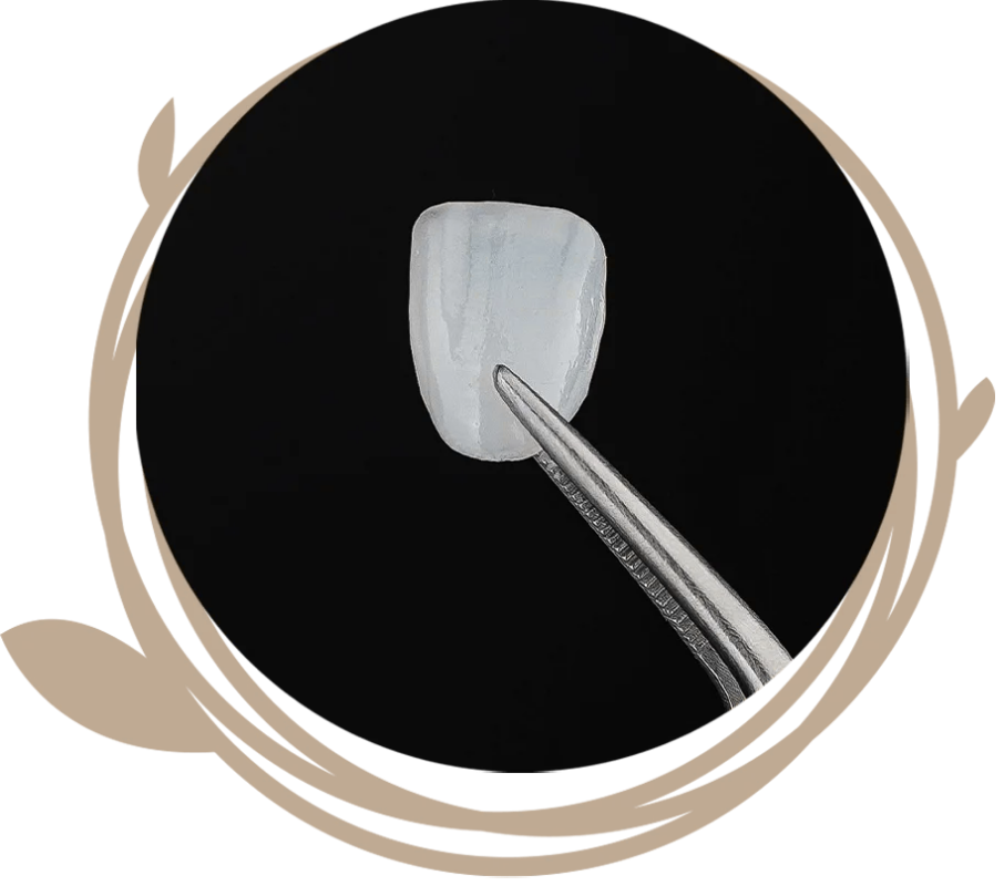 Clovis Family Dentistry|Veneers & Lumineers