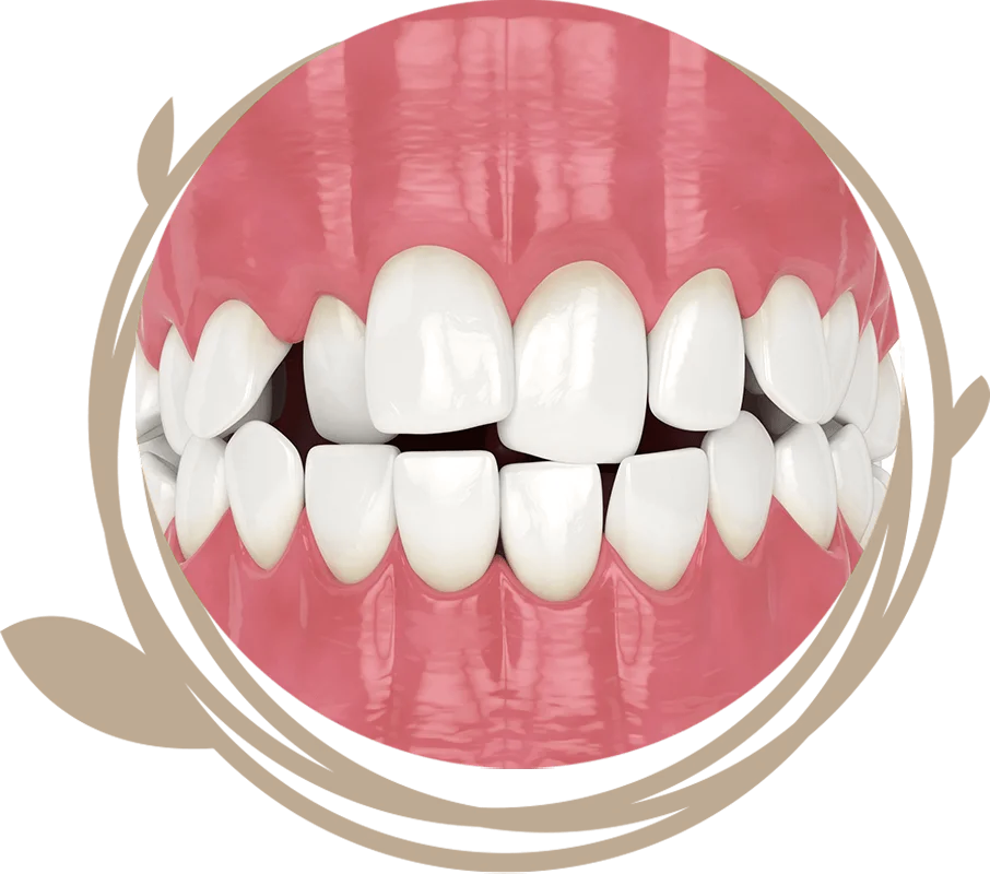 Clovis Family Dentistry|Orthodontics