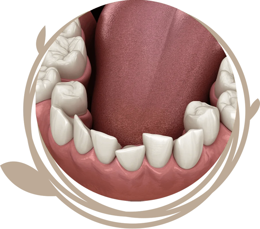Clovis Family Dentistry|Invisalign® Clear Aligners