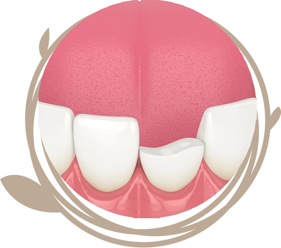 Clovis Family Dentistry|Emergency Dentistry